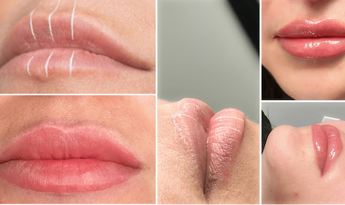 semi permanent makeup lip blush before after mississauga oakville